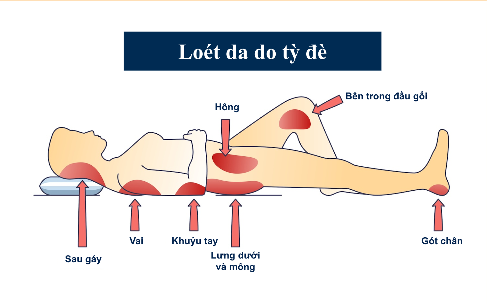 loet-da-ty-de-nguoi-gia-nguoi-benh