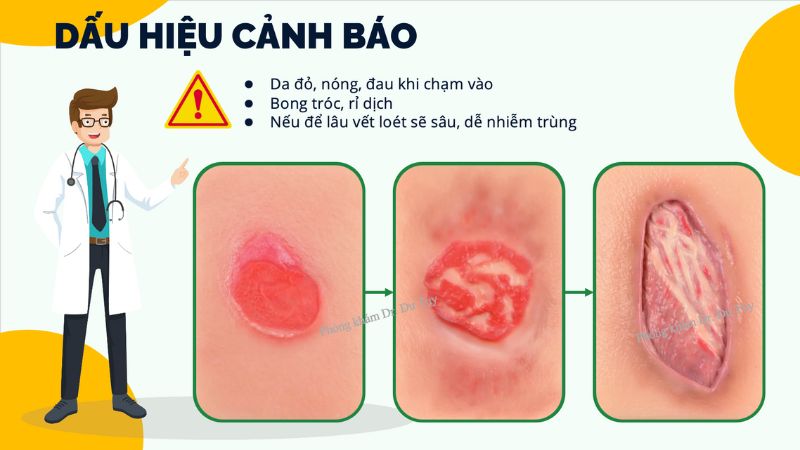 loet-da-o-nguoi-gia-benh-mua-he-01